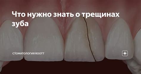 Что нужно знать о трещинах на языке?