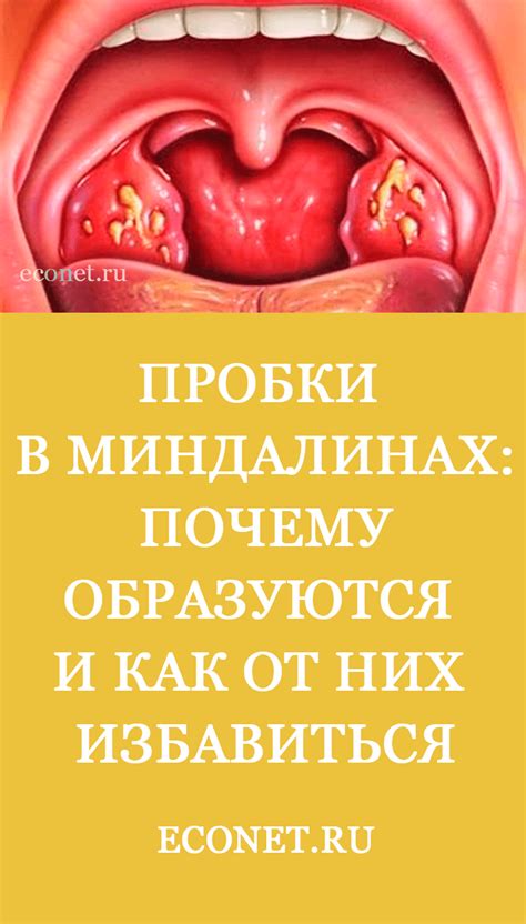 Что происходит, когда аденоиды или миндалины становятся воспаленными?