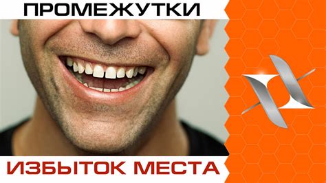 Что такое промежутки и почему они возникают?