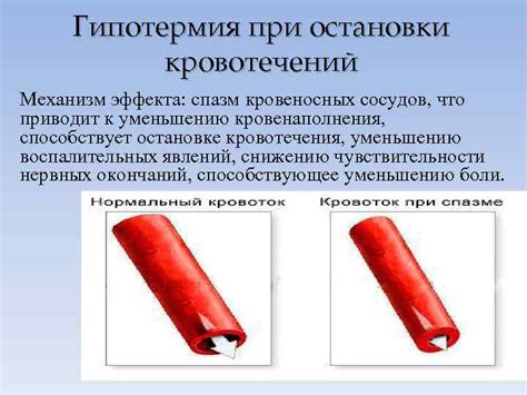 Шаг 3: Создание эффекта анатомических кровеносных патологий