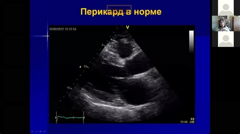  Важность плевры и перикарда в диагностике заболеваний легких 