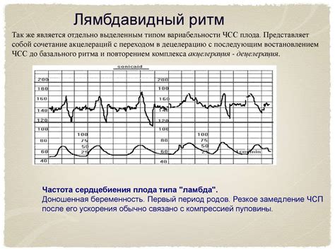  История развития кардиотокографии 