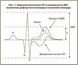  Как происходит запись и анализ кардиотокограммы?
