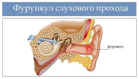  Ошибки при попытках расширения слухового канала в ухе: важно знать 