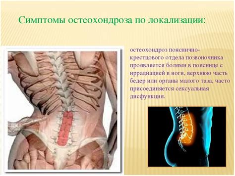  Патологические причины дегенеративных процессов в пояснично-крестцовом отделе
