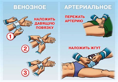  Практические рекомендации по оказанию первой помощи при возникновении трещины в палец на нижней конечности 