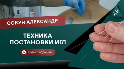  Ручной метод удаления позиционера иглы: приемы и рекомендации 