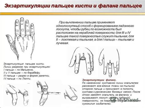  Симптоматика и последствия полученной травмы малого пальца на нижней конечности 