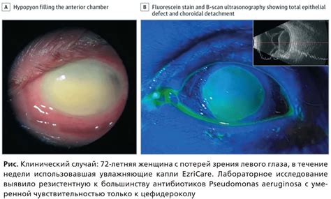  Спиритуальное значение зуда левого глаза в разные дни недели 